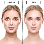 16pcs Anti-Wrinkle Silicone Face Patch Pad - Vianchi Natural Glam