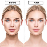 16pcs Anti-Wrinkle Silicone Face Patch Pad - Vianchi Natural Glam